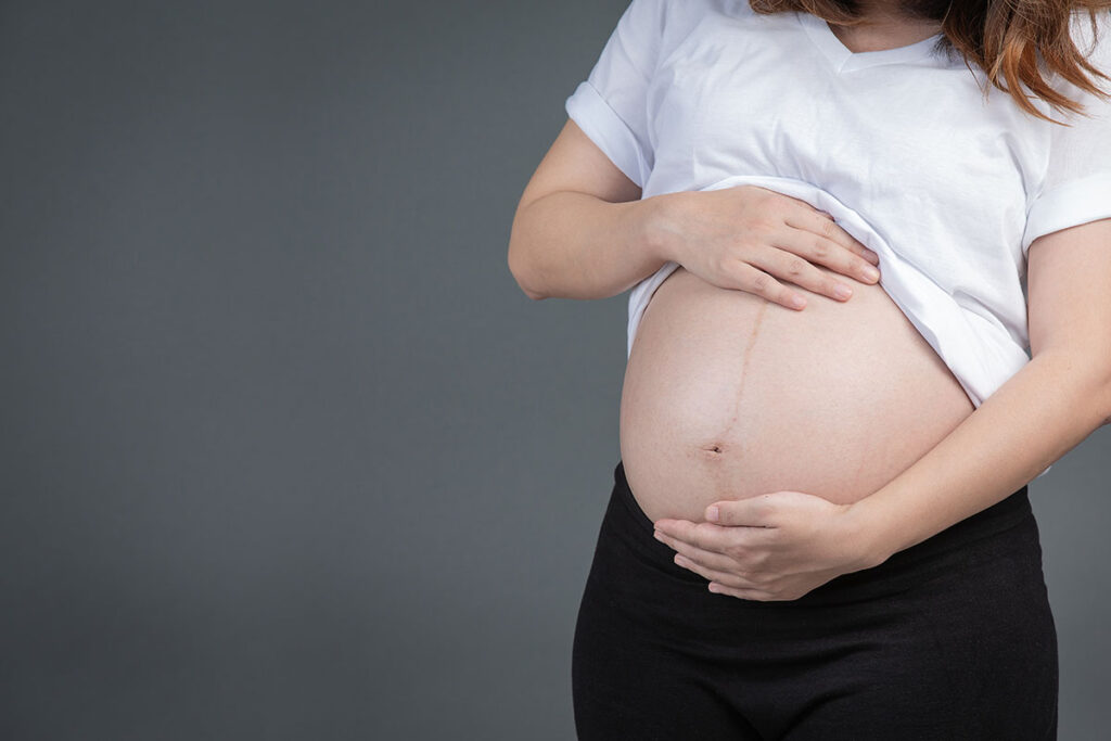Leia mais sobre o artigo Útero retrovertido pode afetar a gravidez?